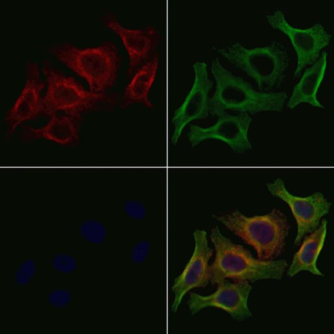 Phospho-VEGF Receptor 2 (Tyr1059) Antibody in Immunocytochemistry (ICC/IF)