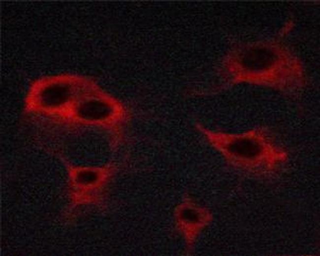 Phospho-VEGF Receptor 2 (Tyr951) Antibody in Immunocytochemistry (ICC/IF)