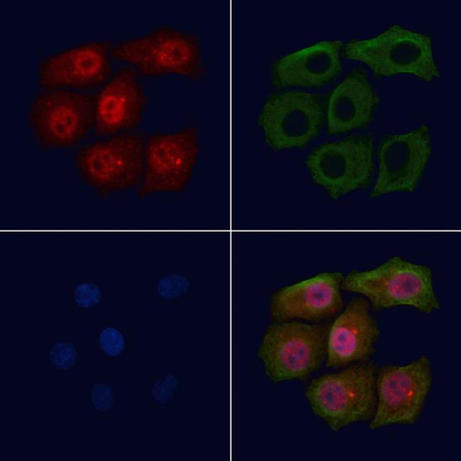 Phospho-BRCA1 (Ser1524) Antibody in Immunocytochemistry (ICC/IF)