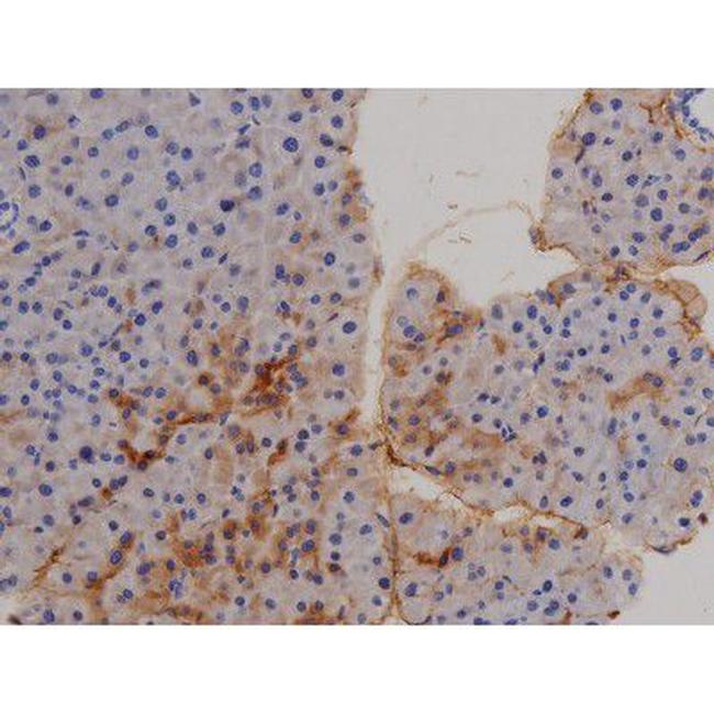 Phospho-STAT6 (Tyr641) Antibody in Immunohistochemistry (Paraffin) (IHC (P))