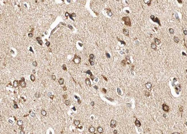 Phospho-GluR1 (Ser863) Antibody in Immunohistochemistry (Paraffin) (IHC (P))