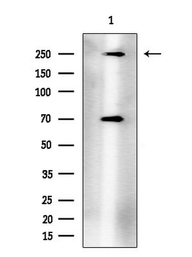 Phospho-mTOR (Thr2446) Antibody in Western Blot (WB)