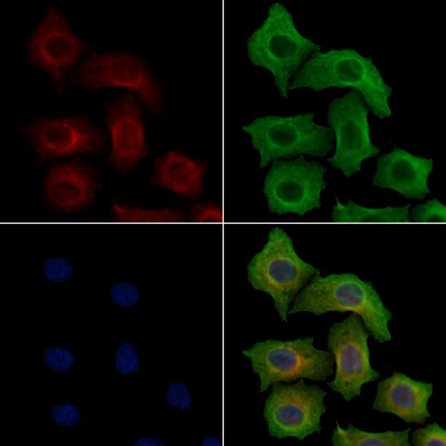 Phospho-ZAP-70 (Tyr319) Antibody in Immunocytochemistry (ICC/IF)