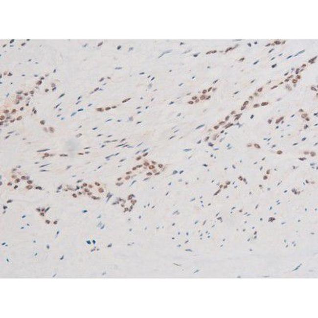 Phospho-SYK (Tyr348) Antibody in Immunohistochemistry (Paraffin) (IHC (P))