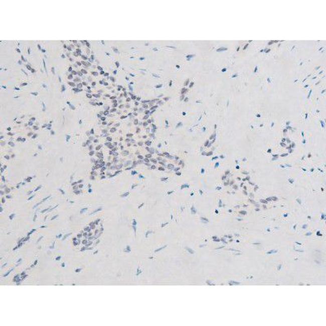 Phospho-SYK (Tyr525) Antibody in Immunohistochemistry (Paraffin) (IHC (P))