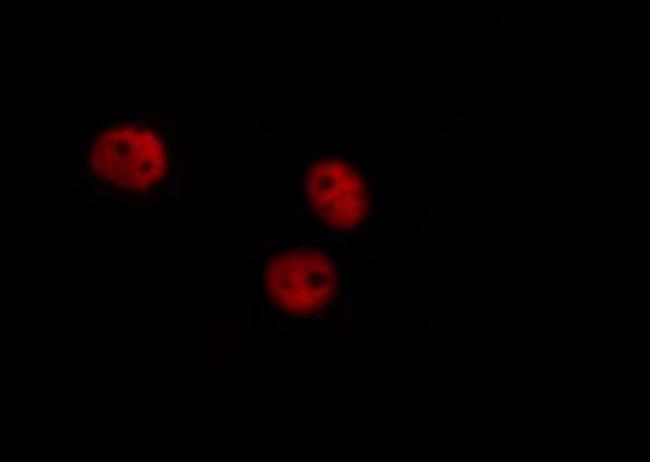 Phospho-GATA4 (Ser262) Antibody in Immunocytochemistry (ICC/IF)