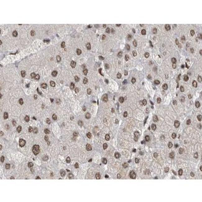 Phospho-JNK1/JNK2/JNK3 (Tyr185) Antibody in Immunohistochemistry (Paraffin) (IHC (P))