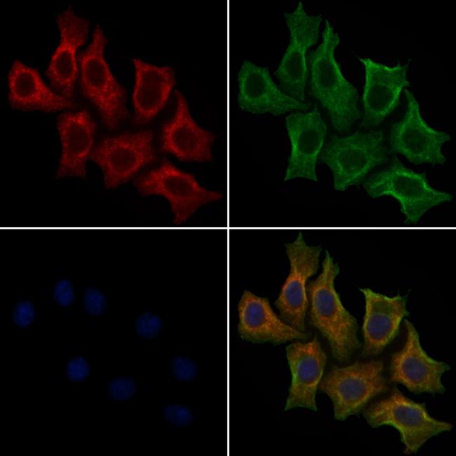 Phospho-TSC2 (Thr1462) Antibody in Immunocytochemistry (ICC/IF)