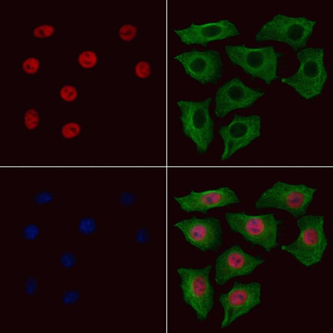 Phospho-STAT5 beta (Ser731) Antibody in Immunocytochemistry (ICC/IF)