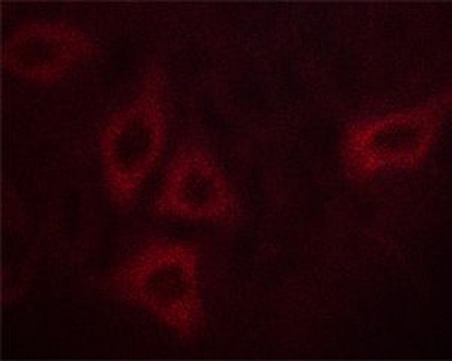 Phospho-Calmodulin 1/2/3 (Thr80, Ser82) Antibody in Immunocytochemistry (ICC/IF)