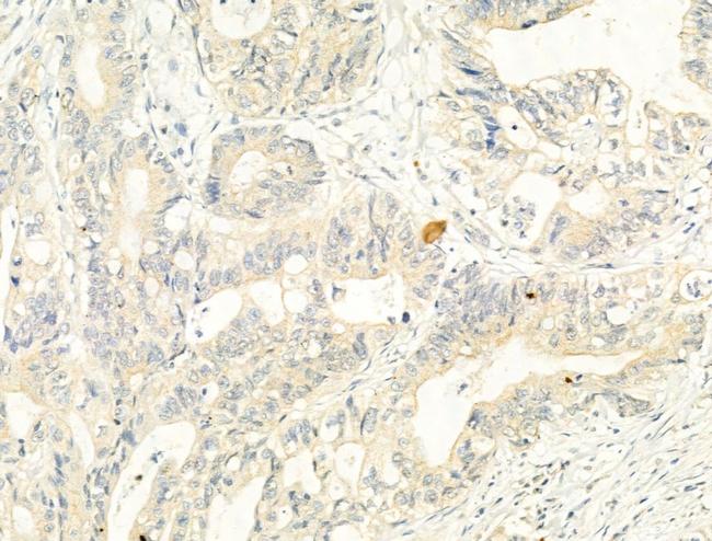 Phospho-ADAM17 (Thr735) Antibody in Immunohistochemistry (Paraffin) (IHC (P))