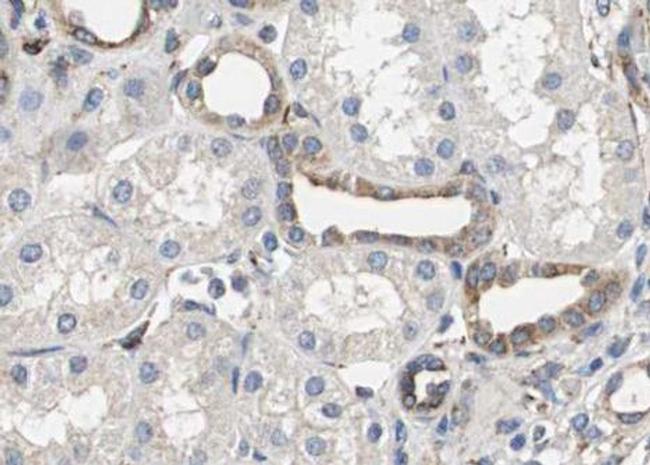 Phospho-Smad3 (Thr179) Antibody in Immunohistochemistry (Paraffin) (IHC (P))