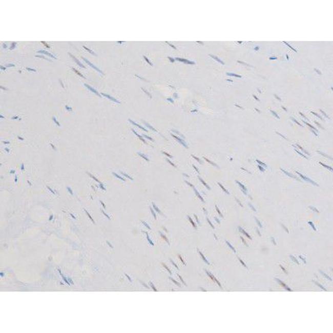 Phospho-Smad3 (Ser213) Antibody in Immunohistochemistry (Paraffin) (IHC (P))