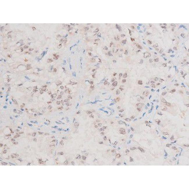 Phospho-XIAP (Ser87) Antibody in Immunohistochemistry (Paraffin) (IHC (P))