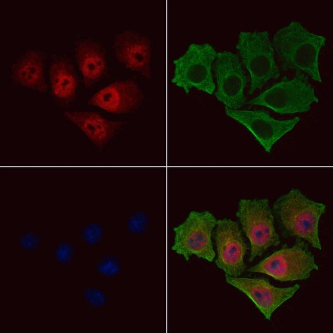 Phospho-NFkB p52/p100 (Ser870) Antibody in Immunocytochemistry (ICC/IF)