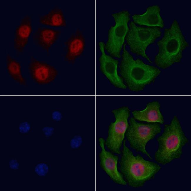 Phospho-NFkB p100 (Ser872) Antibody in Immunocytochemistry (ICC/IF)