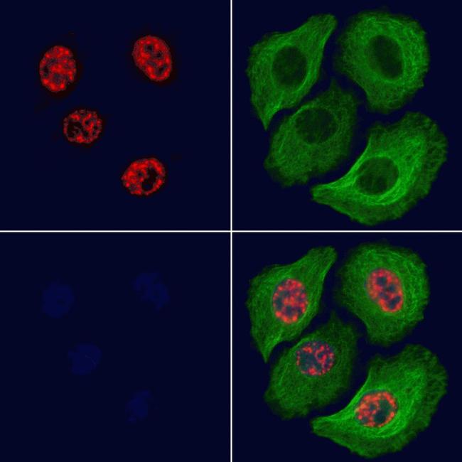 Phospho-MEF2A (Thr312) Antibody in Immunocytochemistry (ICC/IF)