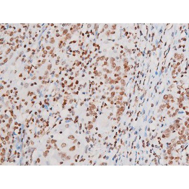 Phospho-NFkB p65 (Thr435) Antibody in Immunohistochemistry (Paraffin) (IHC (P))