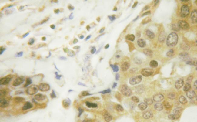 Phospho-NFkB p65 (Ser281) Antibody in Immunohistochemistry (Paraffin) (IHC (P))