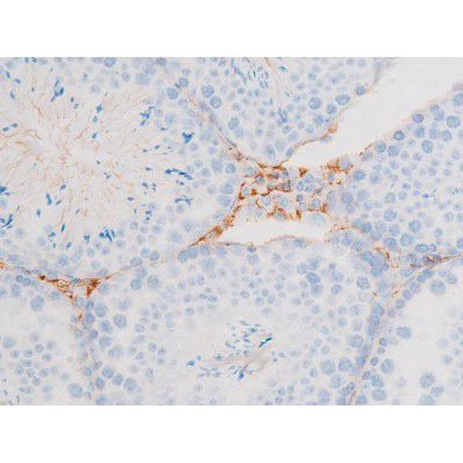 Phospho-Dynamin 1 (Ser774) Antibody in Immunohistochemistry (Paraffin) (IHC (P))