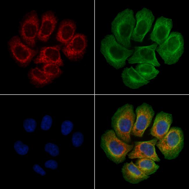 Phospho-FAK (Tyr576) Antibody in Immunocytochemistry (ICC/IF)