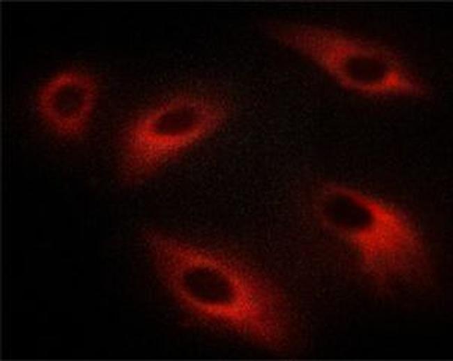 Phospho-PKC zeta (Thr410) Antibody in Immunocytochemistry (ICC/IF)