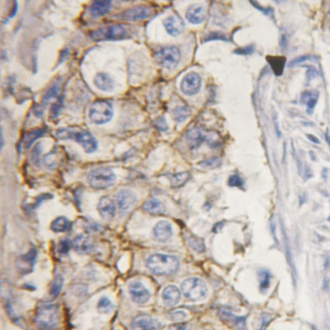 Phospho-PKC delta (Tyr313) Antibody in Immunohistochemistry (Paraffin) (IHC (P))