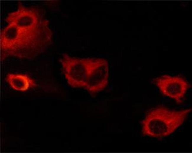 Phospho-Bcl-xL (Thr47) Antibody in Immunocytochemistry (ICC/IF)