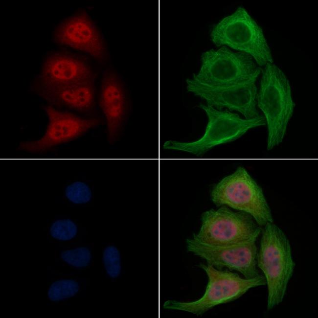 Phospho-FOXO1 (Ser329) Antibody in Immunocytochemistry (ICC/IF)