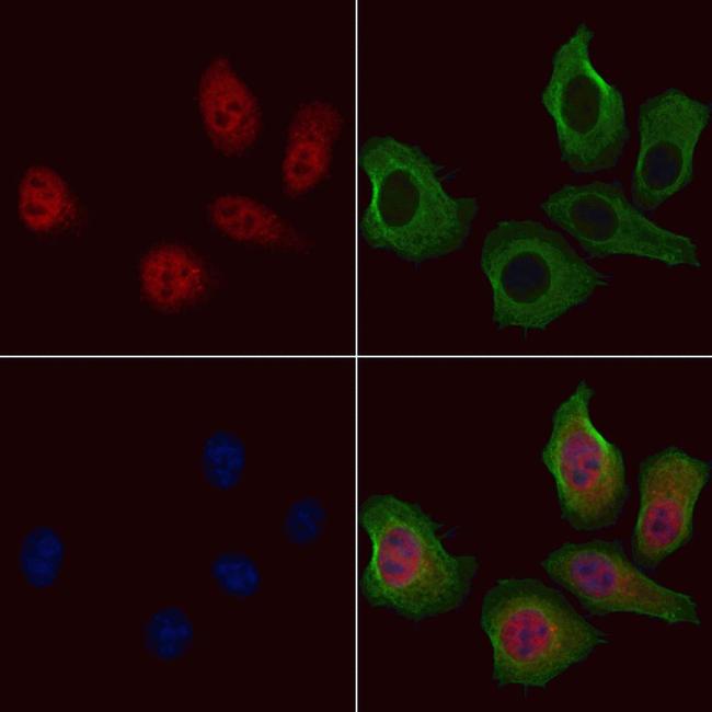 Phospho-FOXO1 (Ser256) Antibody in Immunocytochemistry (ICC/IF)