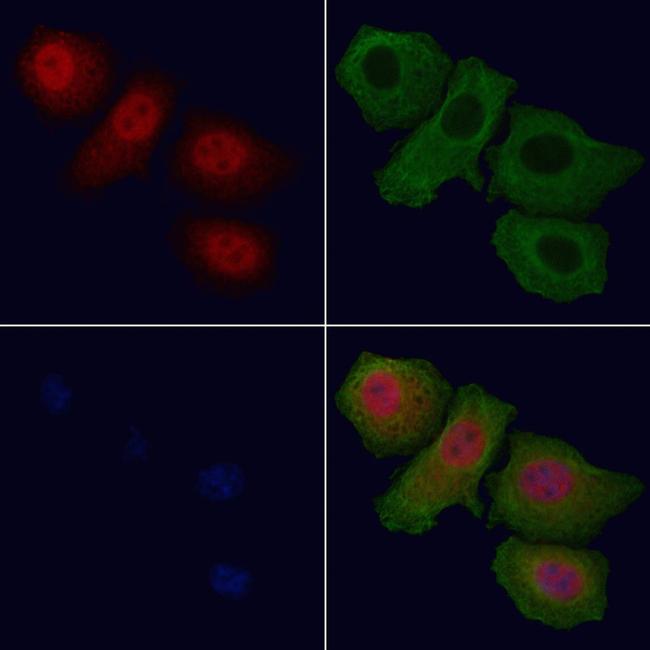 Phospho-FOXO1 (Ser319) Antibody in Immunocytochemistry (ICC/IF)