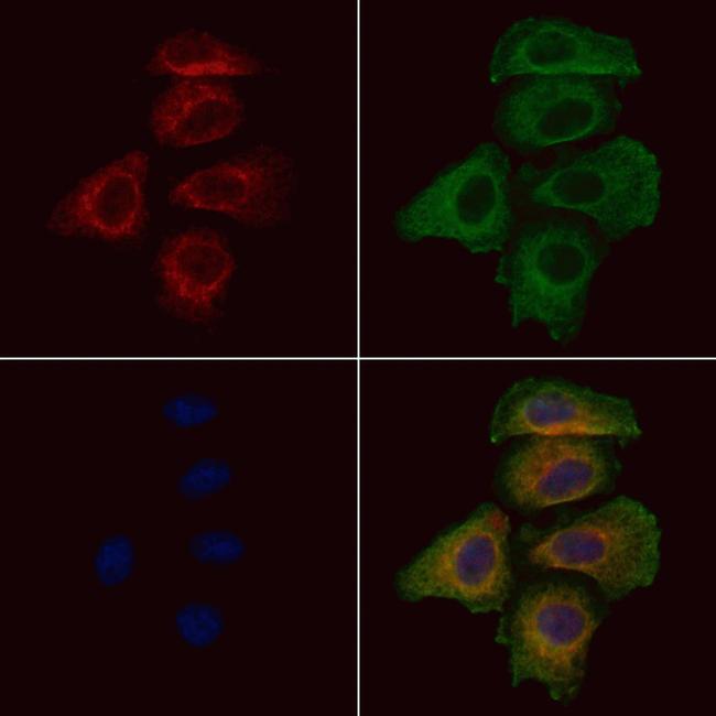 Phospho-NMDAR2B (Tyr1336) Antibody in Immunocytochemistry (ICC/IF)