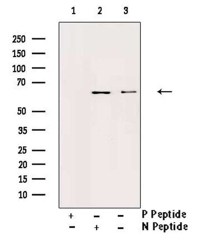 Phospho-IL10RA (Tyr496) Antibody in Western Blot (WB)