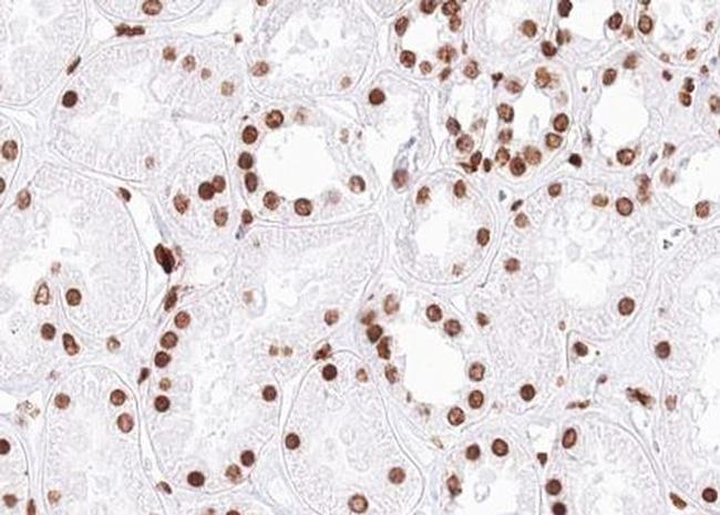 Phospho-SMC1 (Ser957) Antibody in Immunohistochemistry (Paraffin) (IHC (P))