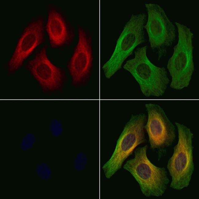 Phospho-PKC mu (Tyr463) Antibody in Immunocytochemistry (ICC/IF)