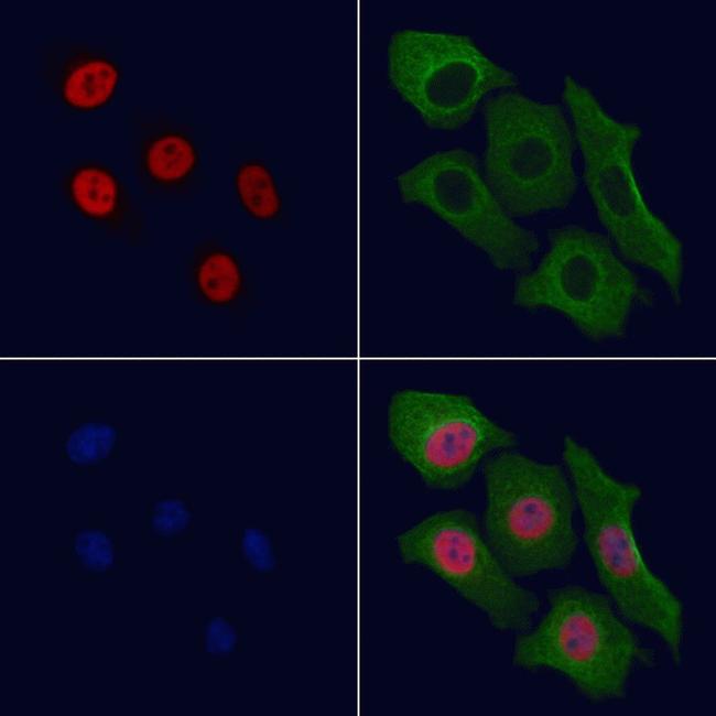 Phospho-TRAP220 (Thr1457) Antibody in Immunocytochemistry (ICC/IF)