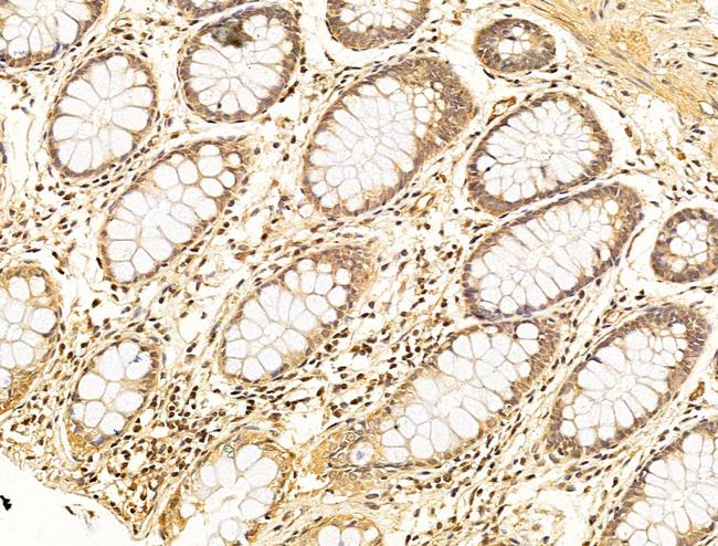 Phospho-SMAD2 (Ser467) Antibody in Immunohistochemistry (Paraffin) (IHC (P))