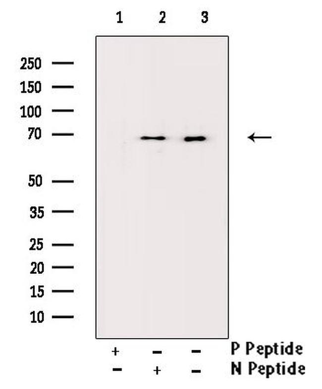 Phospho-SMAD2 (Ser250) Antibody in Western Blot (WB)