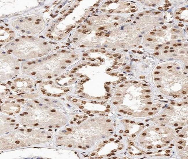 Phospho-p38 MAPK alpha (Tyr182) Antibody in Immunohistochemistry (Paraffin) (IHC (P))