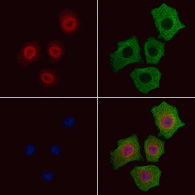 Phospho-p38 MAPK alpha (Thr180) Antibody in Immunocytochemistry (ICC/IF)