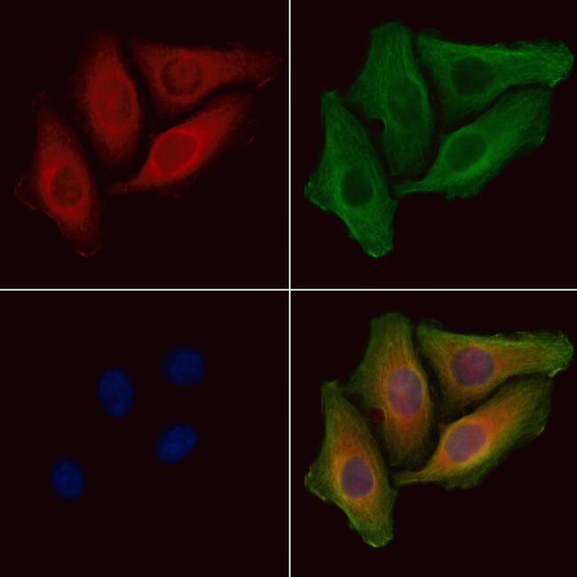 Phospho-BAD (Ser118) Antibody in Immunocytochemistry (ICC/IF)