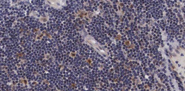 Phospho-ASK1 (Ser966) Antibody in Immunohistochemistry (Paraffin) (IHC (P))