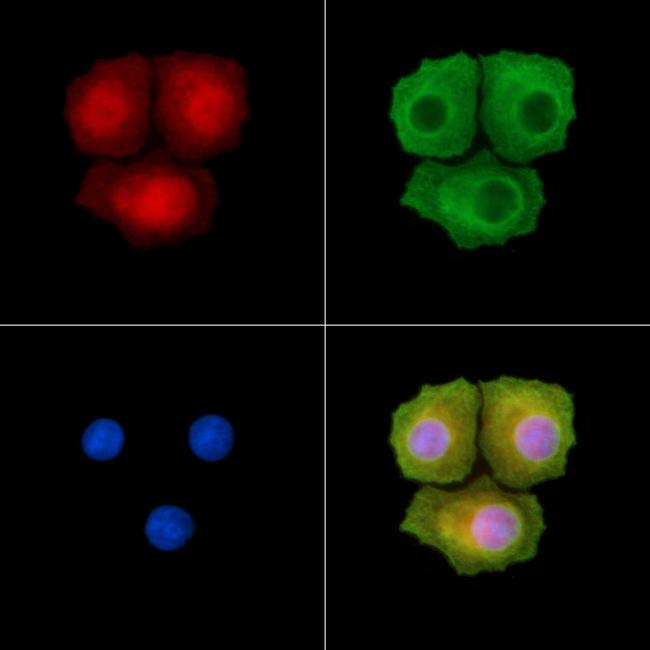 Phospho-FANCD2 (Ser222) Antibody in Immunocytochemistry (ICC/IF)