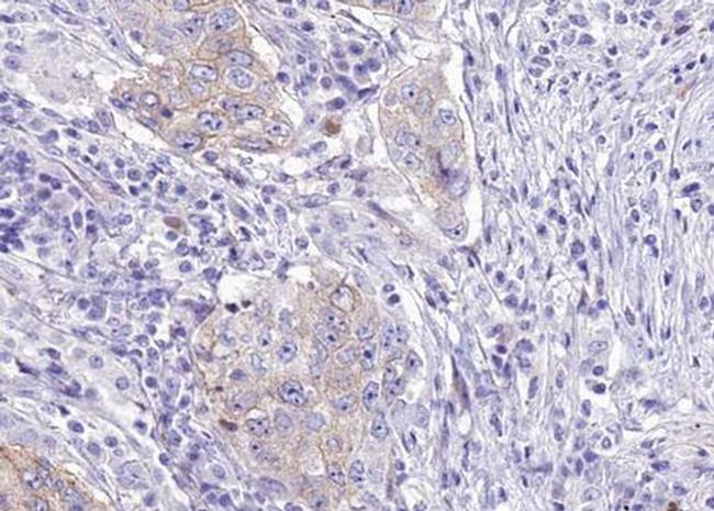 Phospho-WNK1 (Thr60) Antibody in Immunohistochemistry (Paraffin) (IHC (P))