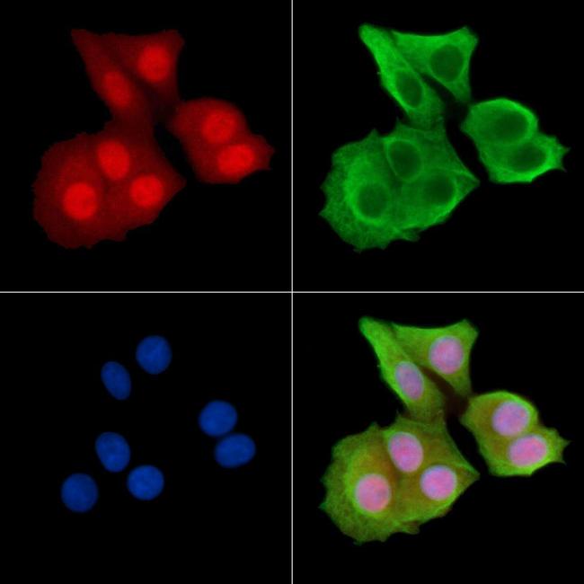 Phospho-HDAC6 (Ser22) Antibody in Immunocytochemistry (ICC/IF)