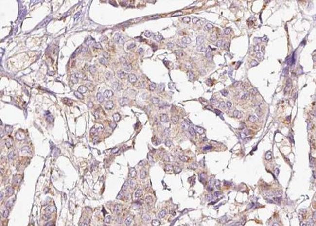 Phospho-DARPP-32 (Thr75) Antibody in Immunohistochemistry (Paraffin) (IHC (P))