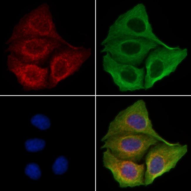 Phospho-CaMKII alpha/delta (Thr286) Antibody in Immunocytochemistry (ICC/IF)