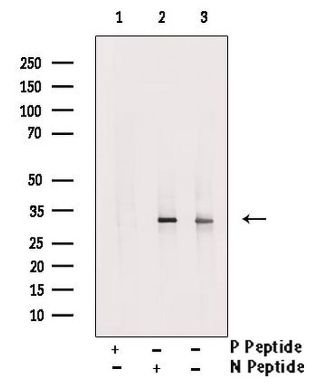 Phospho-SLUG (Ser104) Antibody in Western Blot (WB)