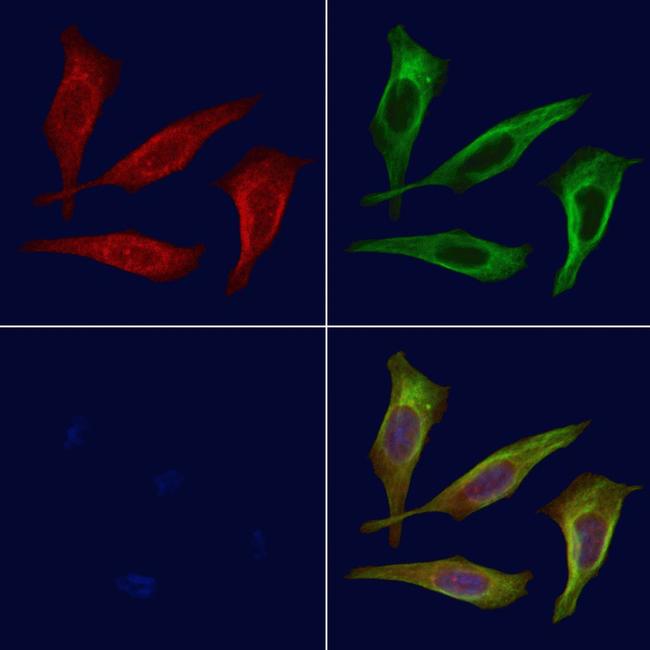 Phospho-ROCK1 (Tyr913) Antibody in Immunocytochemistry (ICC/IF)