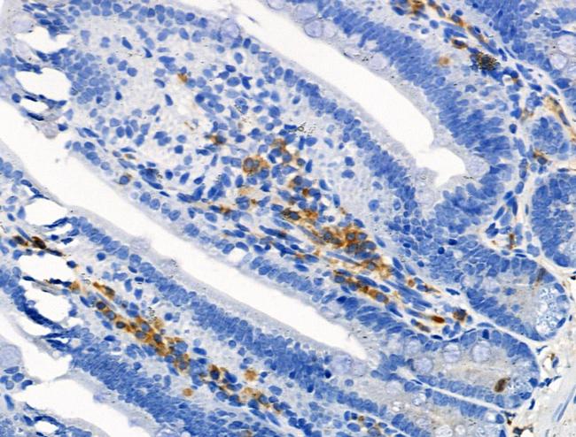 Phospho-ROCK1 (Ser282) Antibody in Immunohistochemistry (Paraffin) (IHC (P))